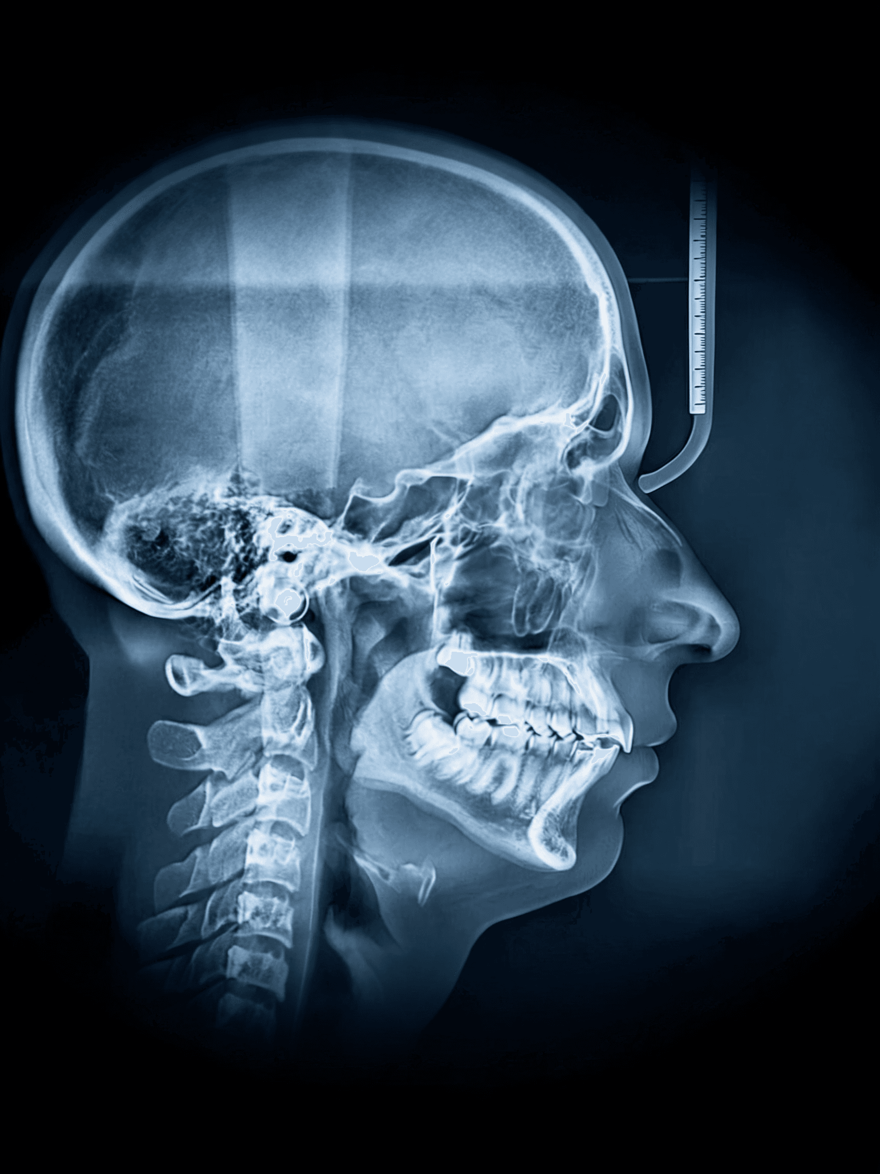 Airway Treatments