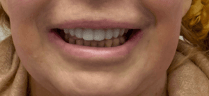 Beyond the Brush: How to Get That Perfect White Smile You've Always Dreamed Of
