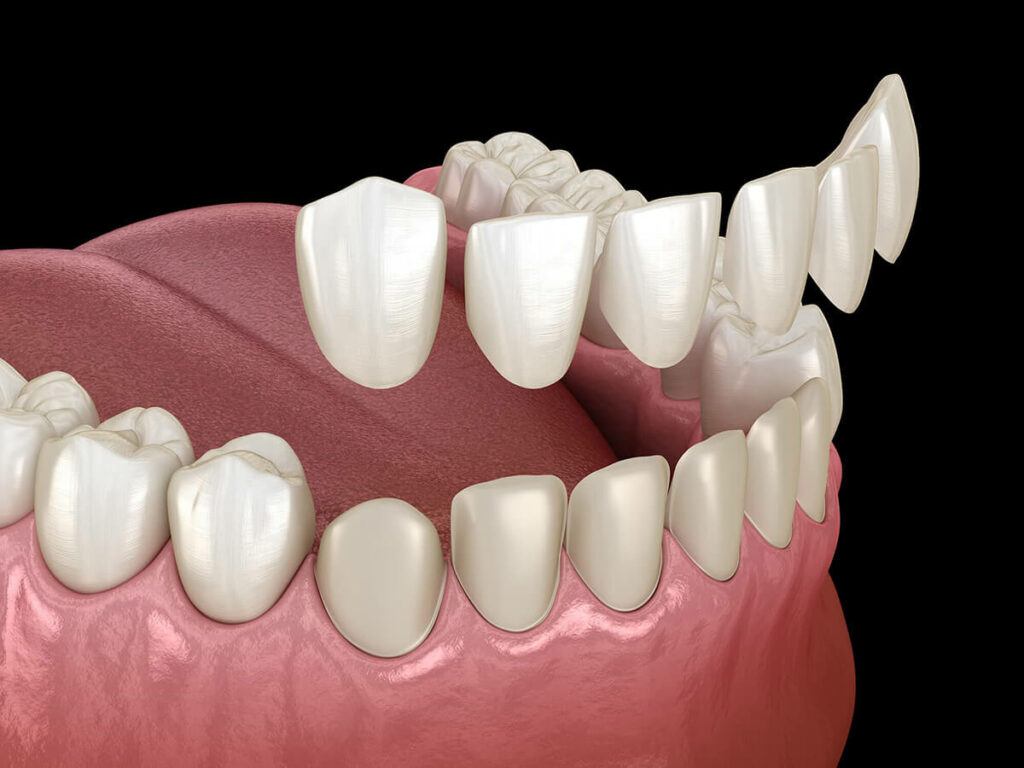 Cosmetic Dentistry and Smile Design at Tribeca Dental Studio NYC
