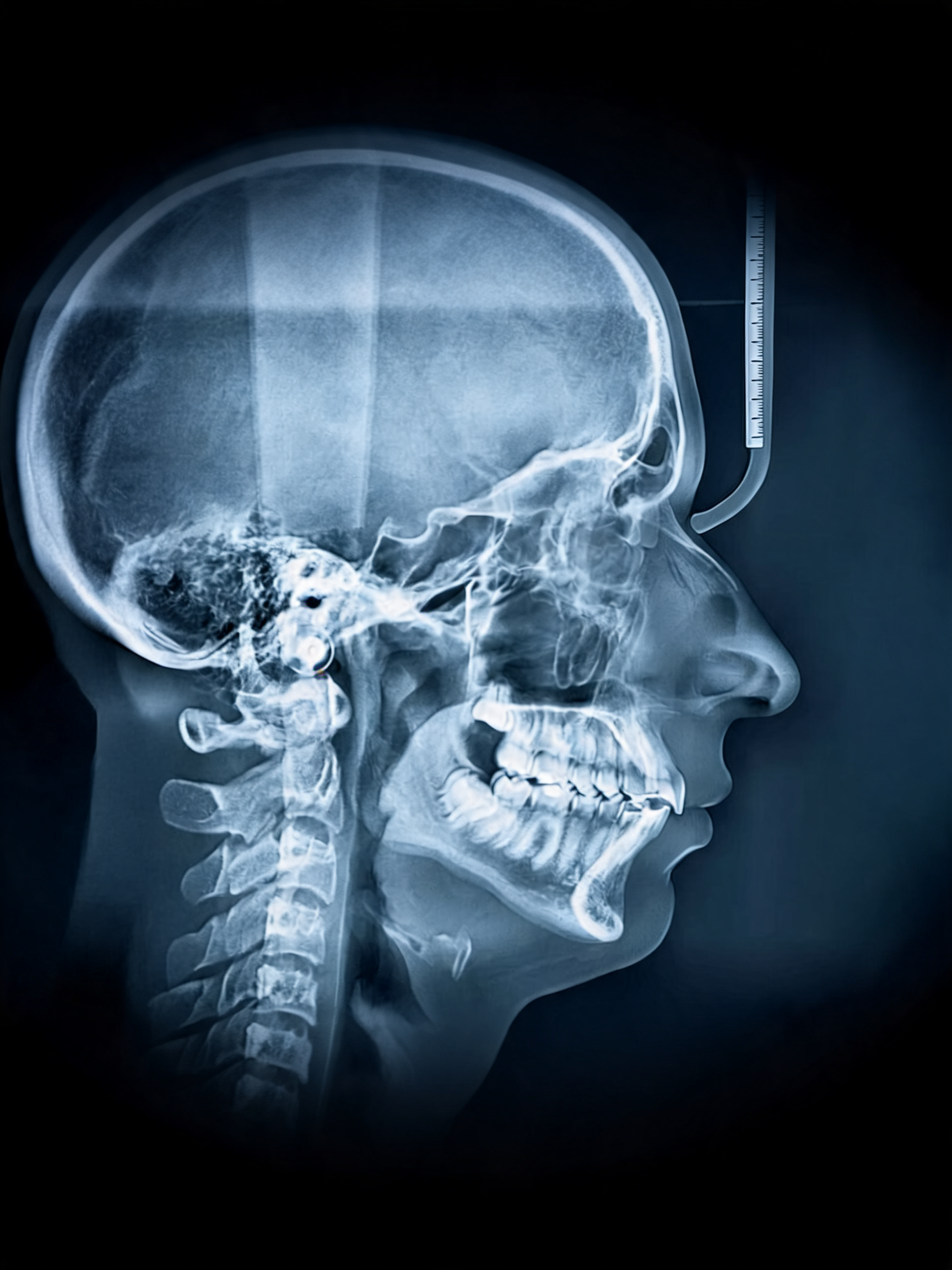 Airway Treatments & Airway Orthodontics Tribeca Dental Studio